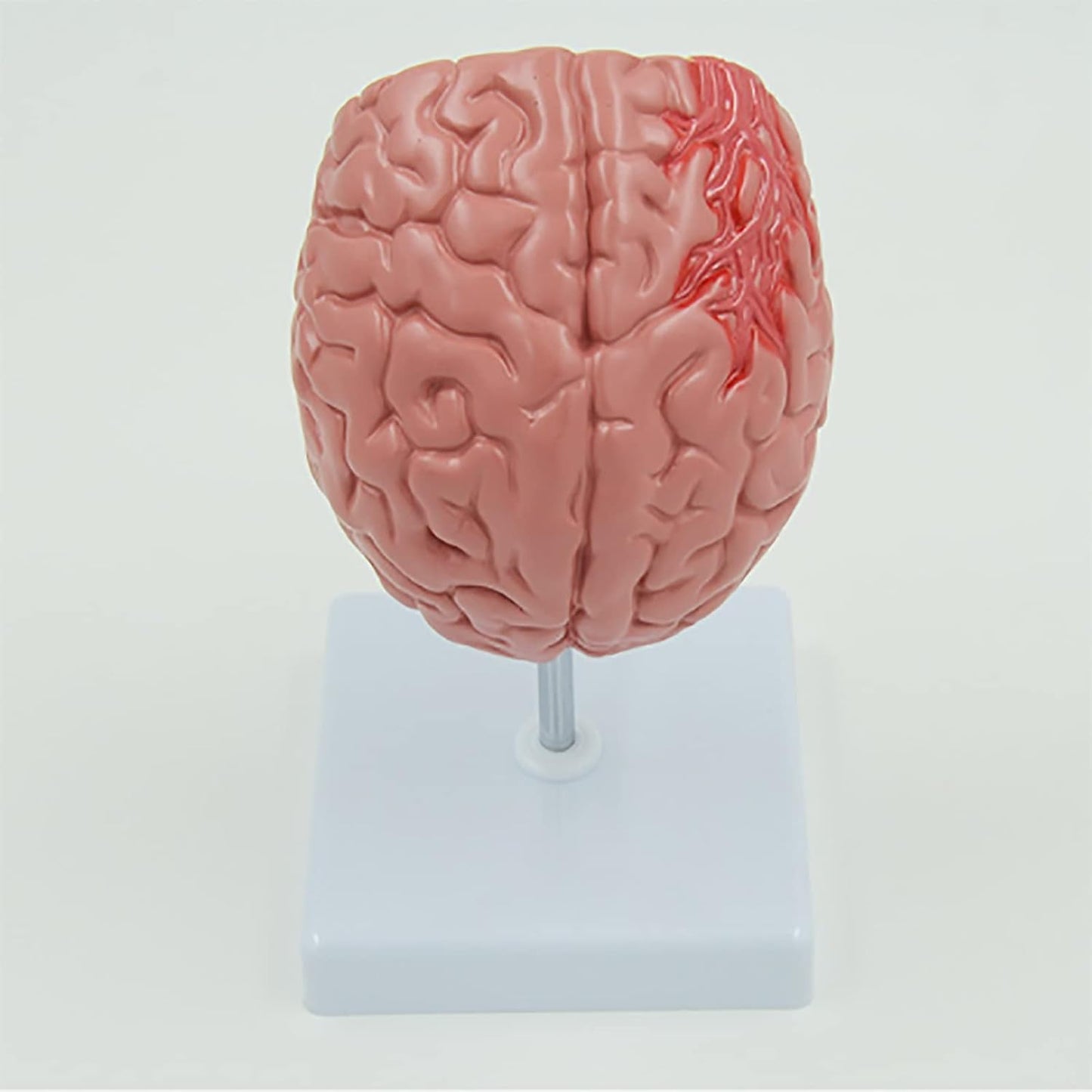 Cerebro Modelo Patologías