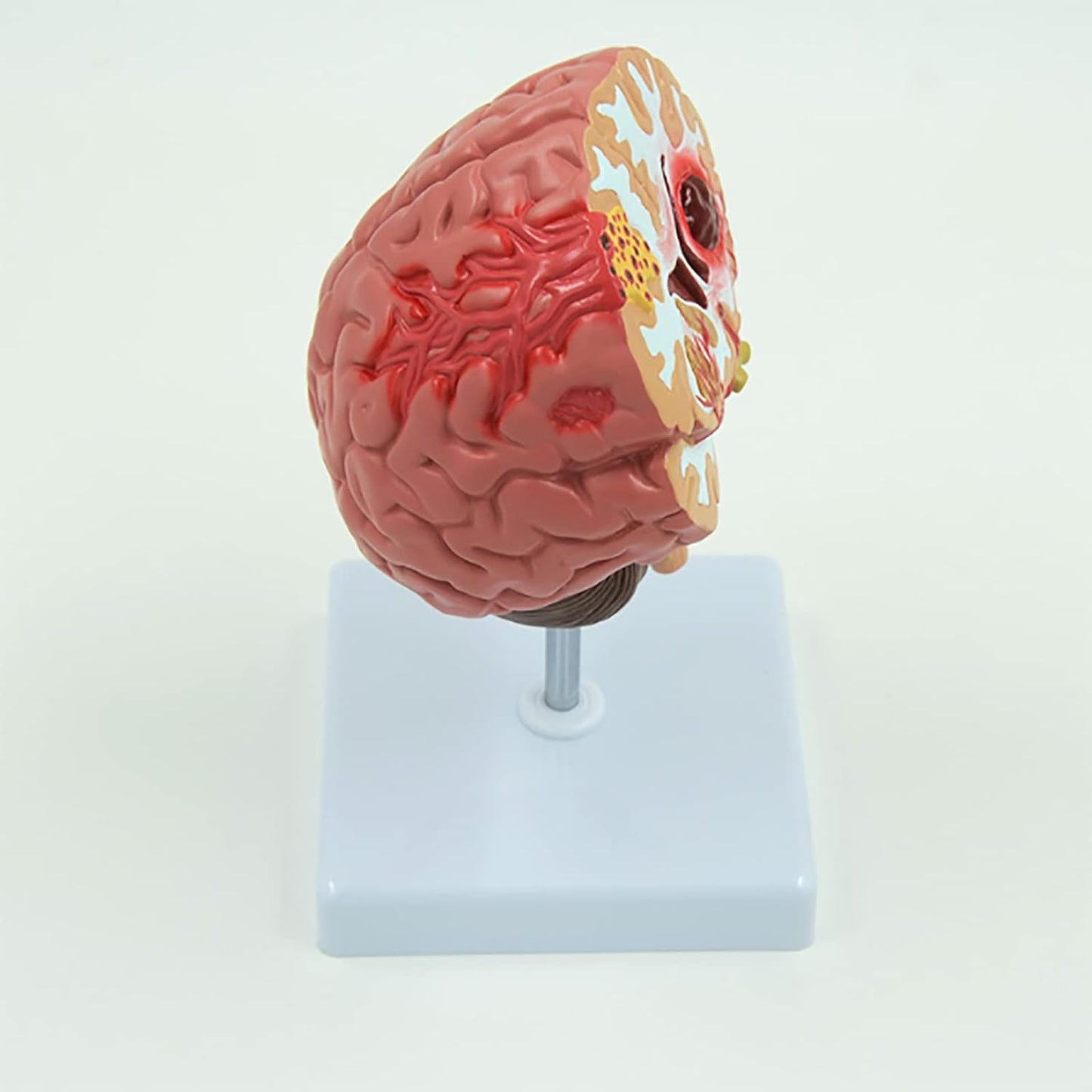 Cerebro Modelo Patologías