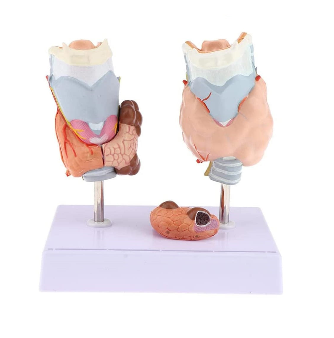 Glándula Tiroides Modelo Anatómico Con Patologías Manatomicos 0178