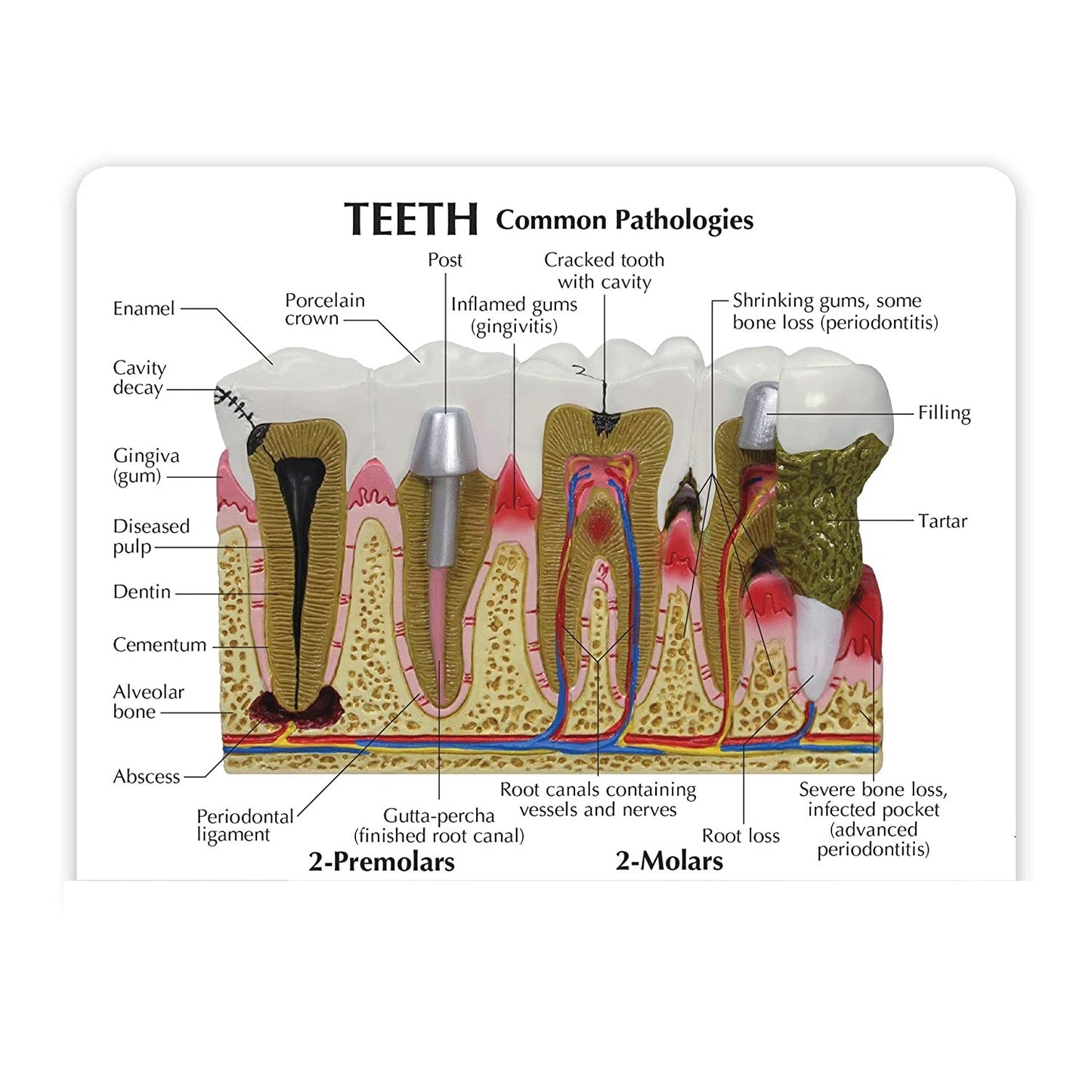 Dientes Patología Oral Enfermedad Periodontal