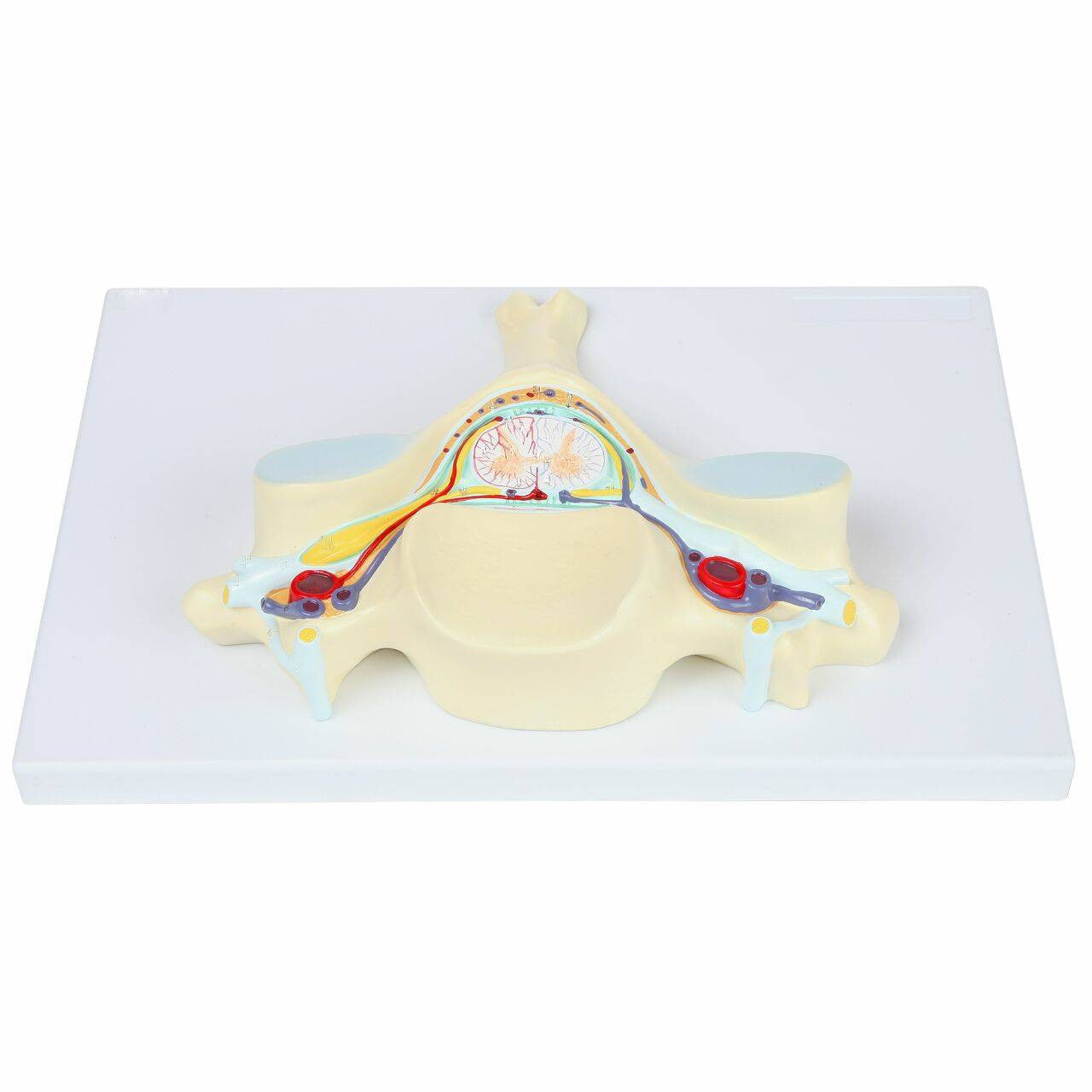 Quinta Vértebra Cervical Corte Transversal