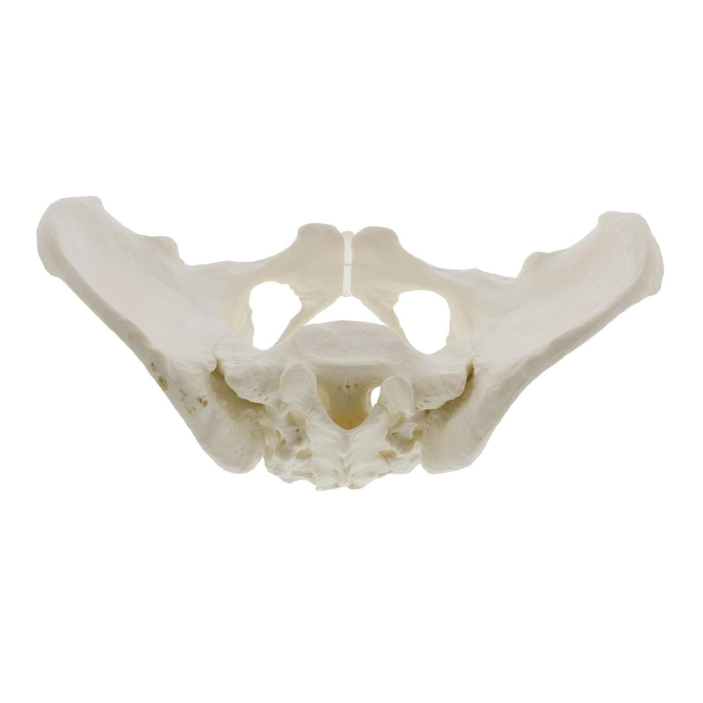 Pelvis Femenina Modelo Óseo